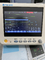 Wieloparametrowy monitor ratunkowy szpitala Mini monitor pacjenta pogotowia ratunkowego