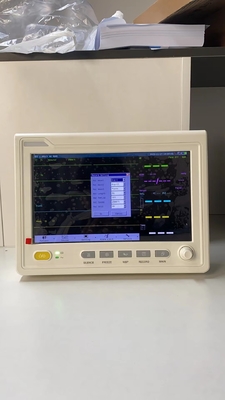 Urządzenia pogotowia ratunkowego Urządzenia medyczne EKG NIBP Monitor pacjenta W szpitalu