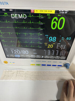 Przenośny monitor przy łóżku z EKG SPO2 NIBP TEMP RESP Opcjonalna gwarancja ETCO2-klasa II 1 rok